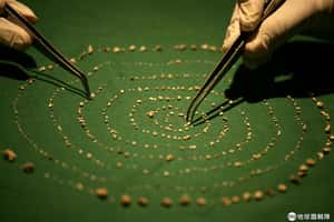 醫生取出526顆牙齒  全在印度男童嘴巴裡