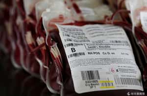 輸年輕人血防老化？美國新創公司惹議