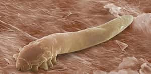 為我們清潔毛孔的小蟎蟲 面臨滅絕危機