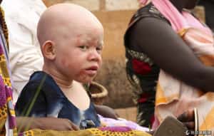 獵巫行動 坦國為白子逮225名巫醫