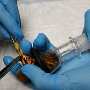 【地球 24小時】12/24 為這個8公分的小生物動手術？