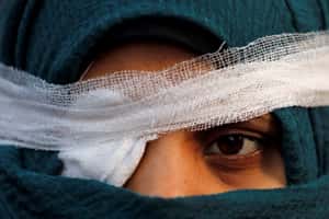 【地球 24小時】聲援那位眼睛受傷的示威者