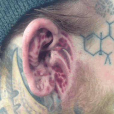 An abstract black and grey tattoo on the face, incorporating geometric shapes and patterns around the ear — by tyler_whitlock, los angeles