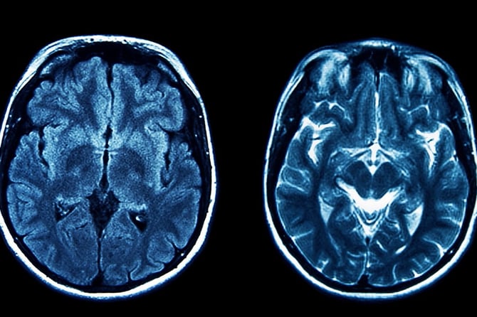 Dementia Care at Nillumbik Medical Centre