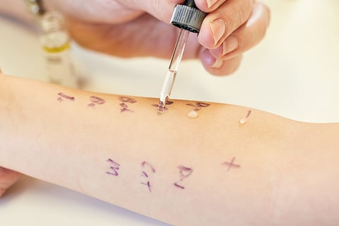 A close-up of a skin prick allergy and immunology test being performed on a patient's forearm with numbers and marks indicating different allergens.