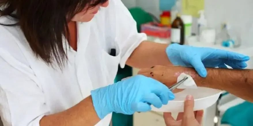 A healthcare professional cleans a  wound using medical instruments, 