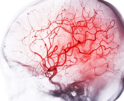 Multi-Scale Brain Imaging