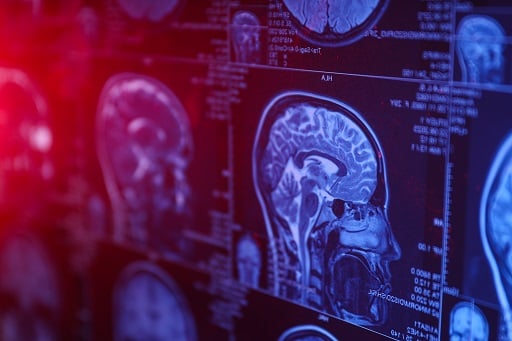 brain imaging