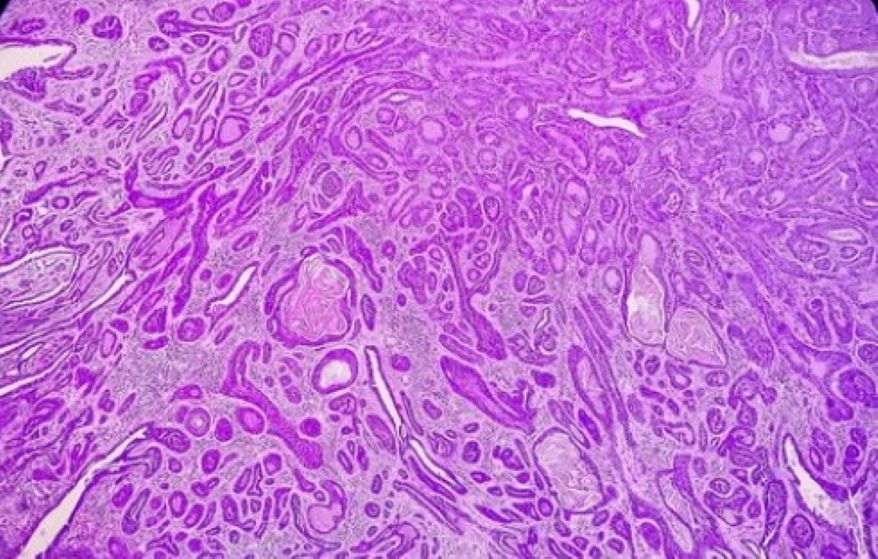 Histology in Cancer Diagnosis