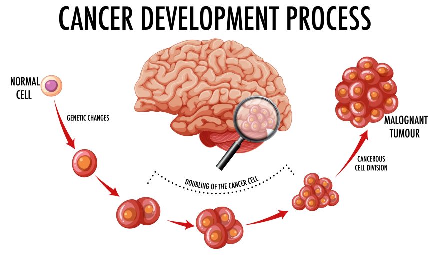 Cancer Causes