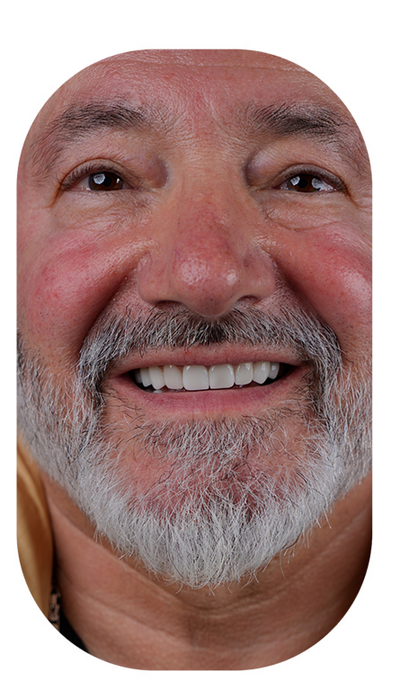 treatment-content-image-1