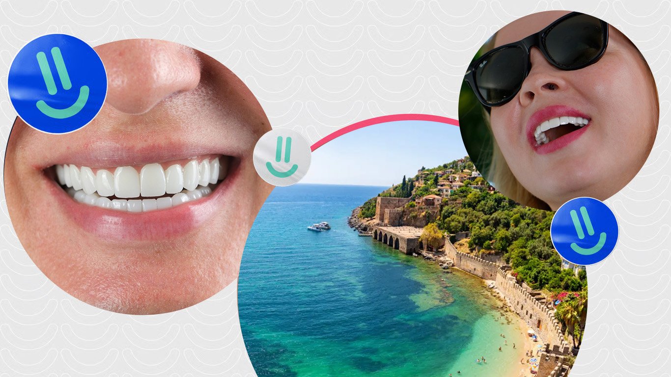 Hollywood Smile in Turkije: Uw Dromlach Binnen Bereik