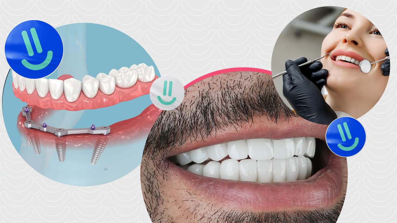 All-on-4 Zahnimplantate in der Türkei: Ihr umfassender Leitfaden für 2025