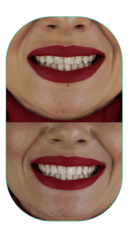treatment-content-image-2
