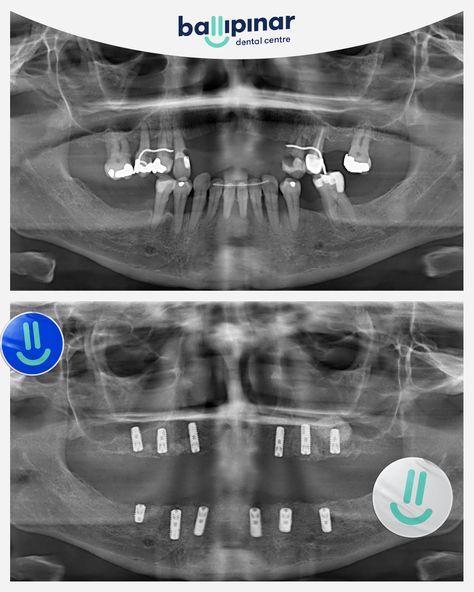 treatment-content-image-1