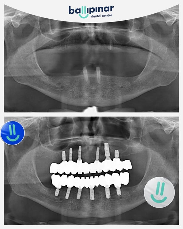 treatment-content-image-2