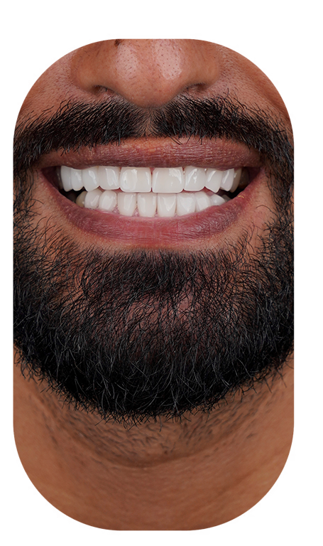 treatment-content-image-2