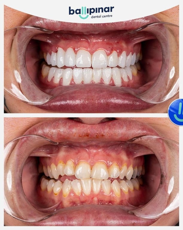 treatment-content-image-2