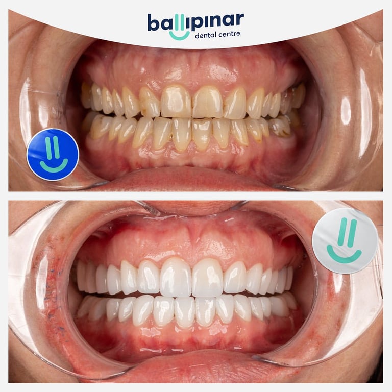 treatment-content-image-2