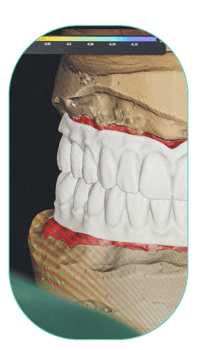treatment-content-image-1