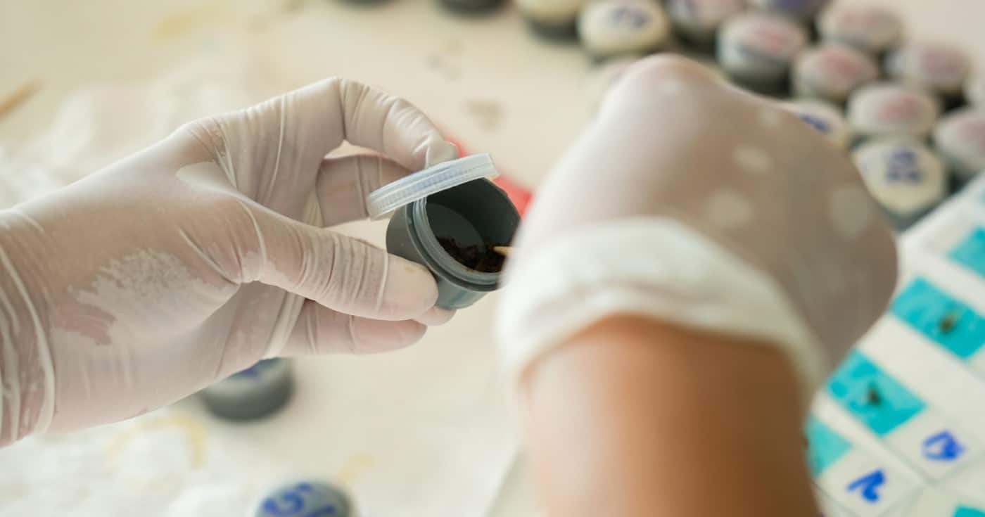 Ung thư đại tràng