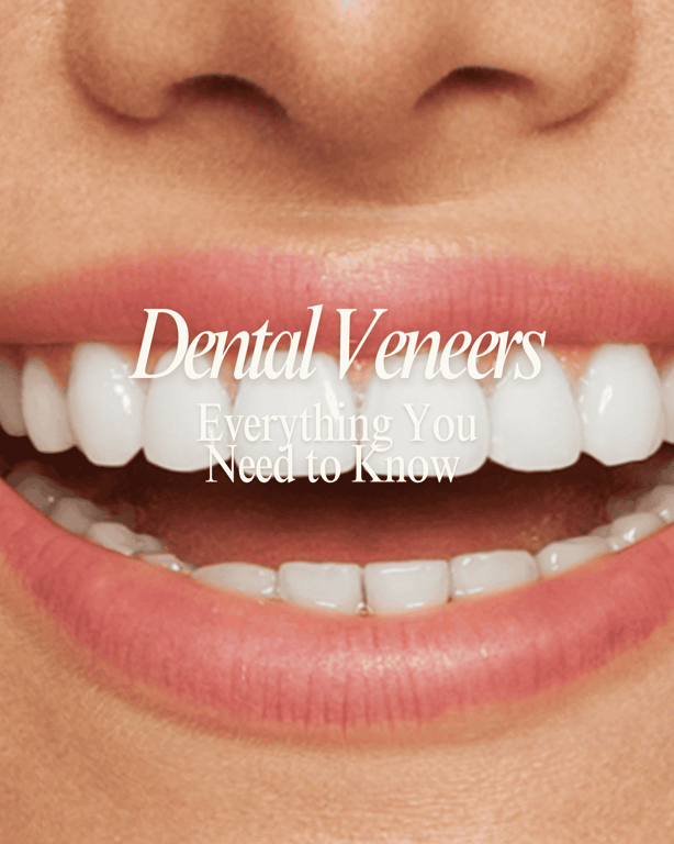 Everything You Need to Know About Dental Veneers: Costs, Process, and Results