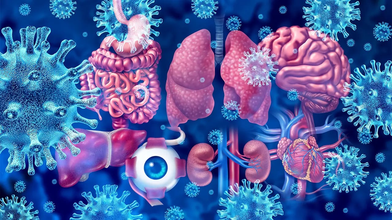 NIH RECOVER Launches Three New Clinical Trials Targeting Long COVID