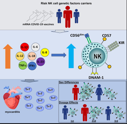Aktivierung natürlicher Killerzellen nach COVID-19 mRNA-Injektion mit dem Auftreten akuter Myokarditis verbunden