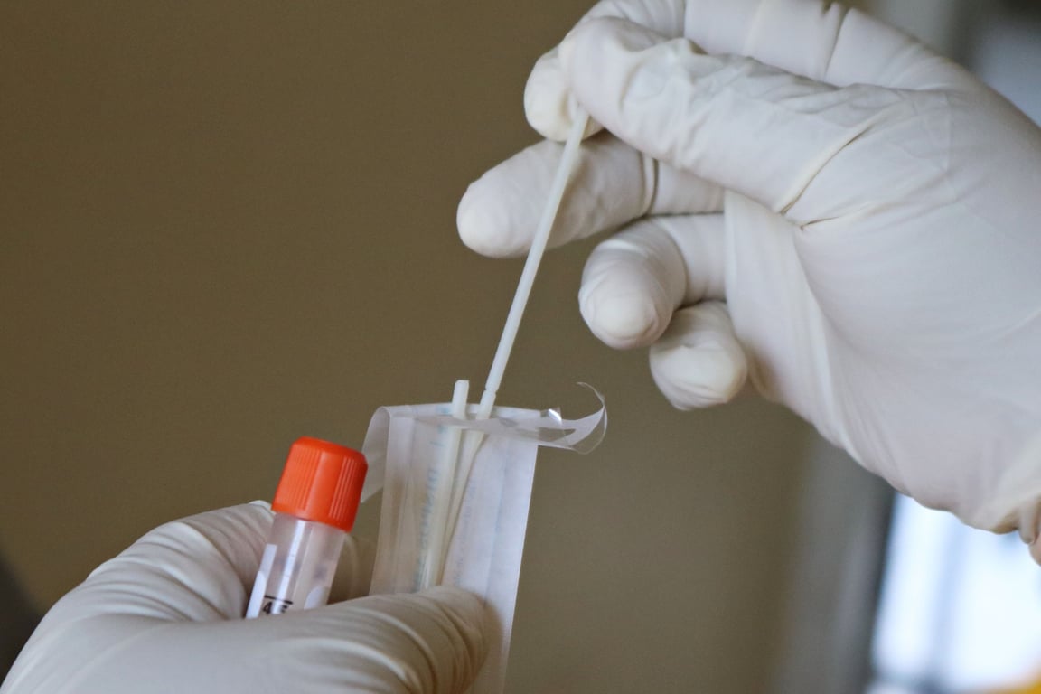 Emerging COVID 19 Test Vendor Under Investigation For Improperly 