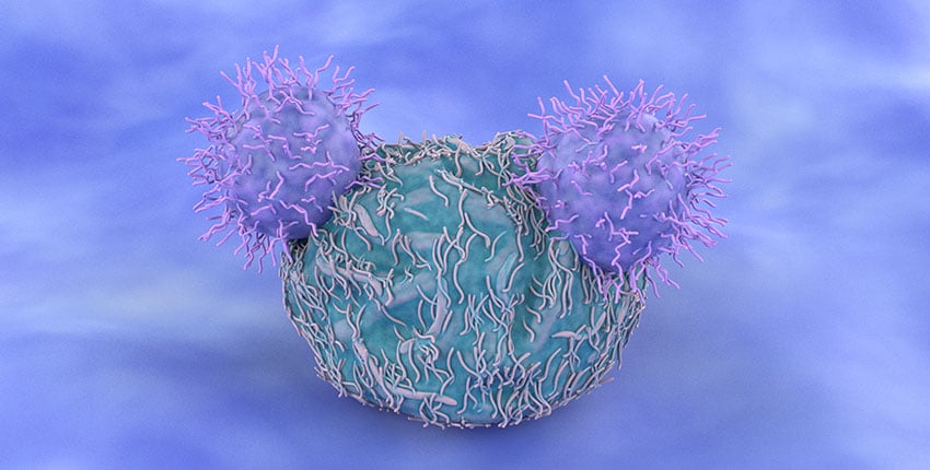 CAR-T Therapy Liso-cel Outperforms Standard Care in Large B-Cell ...