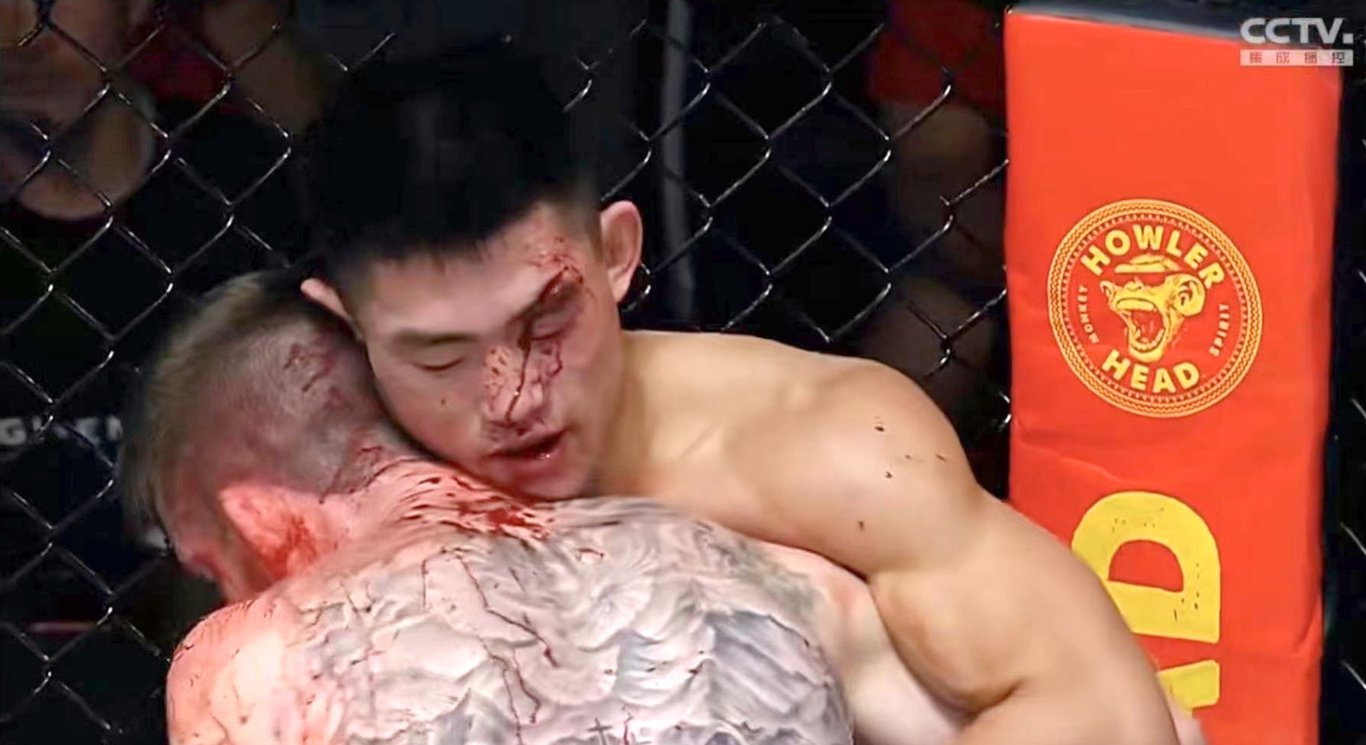 Feature image of Tough Break for MMA Star Song Yadong in Thrilling UFC Vegas 60 Fight