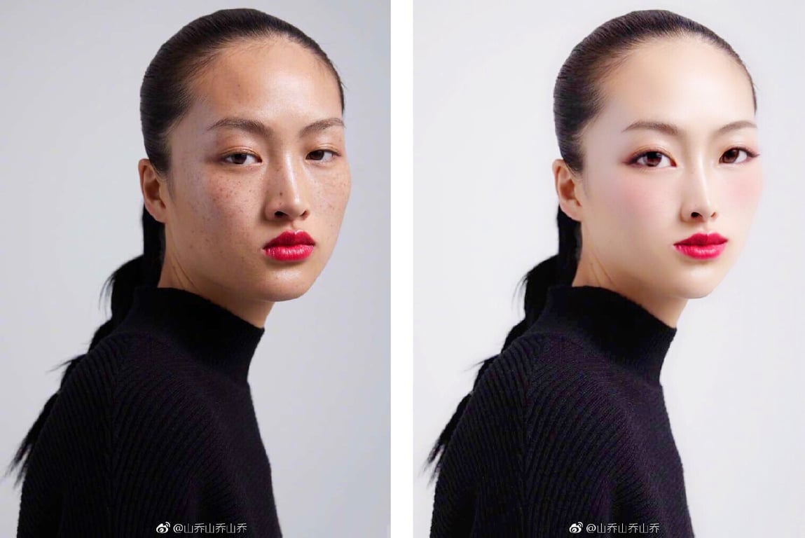 Chinese Model's Freckled Face Divides Netizens — RADII