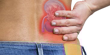 Advanced Kidney Stones Care: What Modern Programs Teach Us