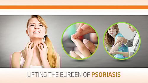 LIFTING THE BURDEN OF PSORIASIS