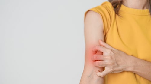 Understanding Common Skin Infections in Dubai