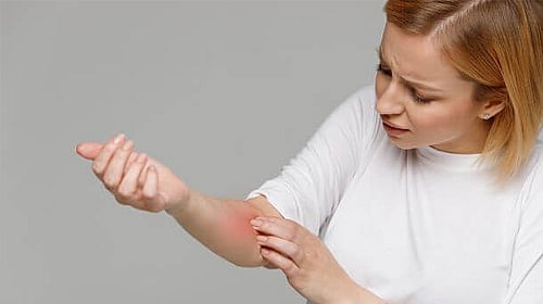 Understanding Common Skin Diseases in Dubai and Where to Find the Right Care