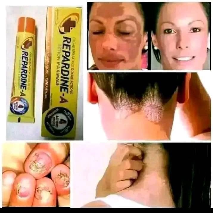 Repardine-A – Creme Reparador de Ação Máxima