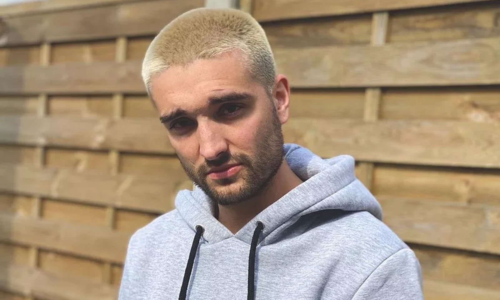 Tom Parker, do The Wanted, revela diagnóstico de tumor inoperável no cérebro