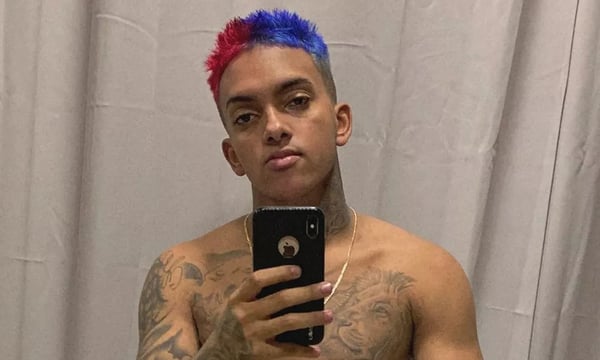 MC Brinquedo sofre acidente de moto: “Deus me deixou viver”