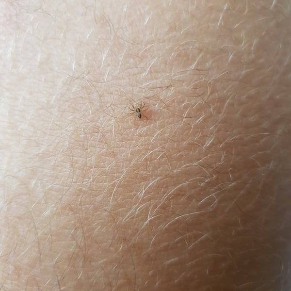 Thanatus dorsilineatus