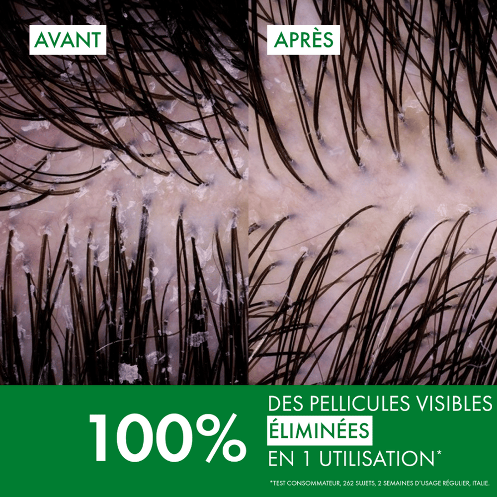Shampooing Anti-Pelliculaire DS Cheveux Secs - Image 2