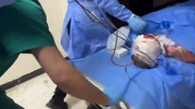 20 طبيباً يحاولون إنقاذه.. قطعت يداه أثناء تنظيف “سبلت” في الرمادي