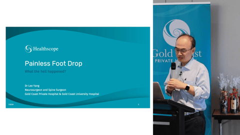 Painless Foot Drop