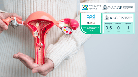 Diagnosis and Management of Endometrial Cancer Professor Felix Chan RACGP CPD Activity