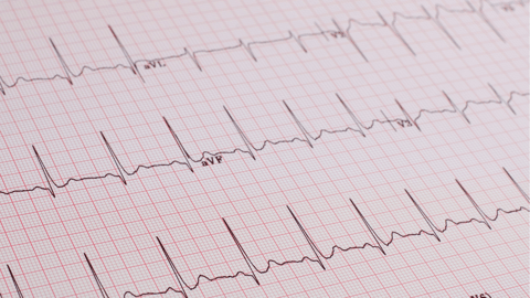 ECG Masterclass Webinar