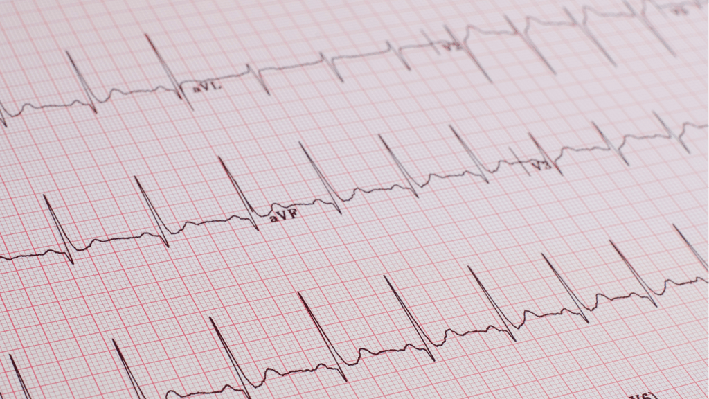 ECG Masterclass Webinar