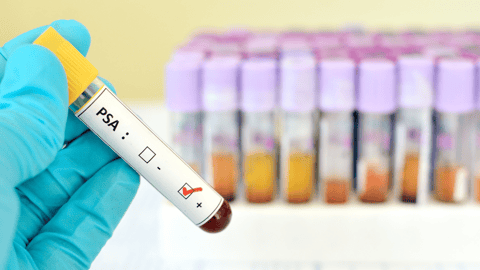 PSA Screening Webinar