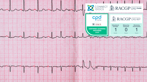 Atrial Fibrillation in 2024 RACGP CPD Home Course
