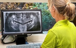 Renate Nijsen consulteert roentgen foto