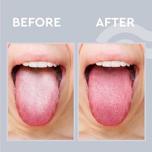 GUBB Metal Tongue Cleaner For Kids & Adults (with Loop) image 5